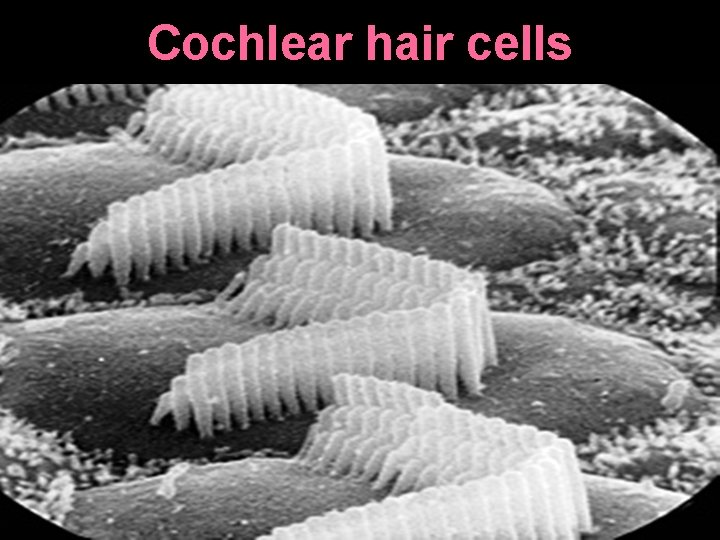Cochlear hair cells 