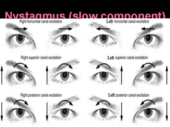 Nystagmus (slow component) 