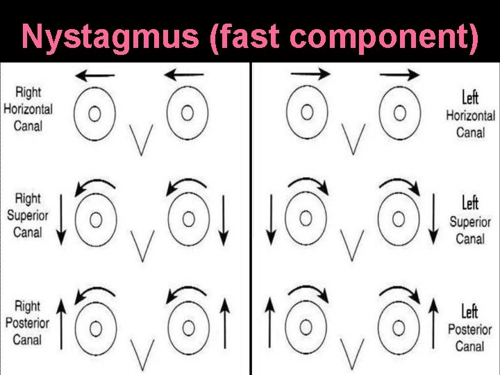 Nystagmus (fast component) 