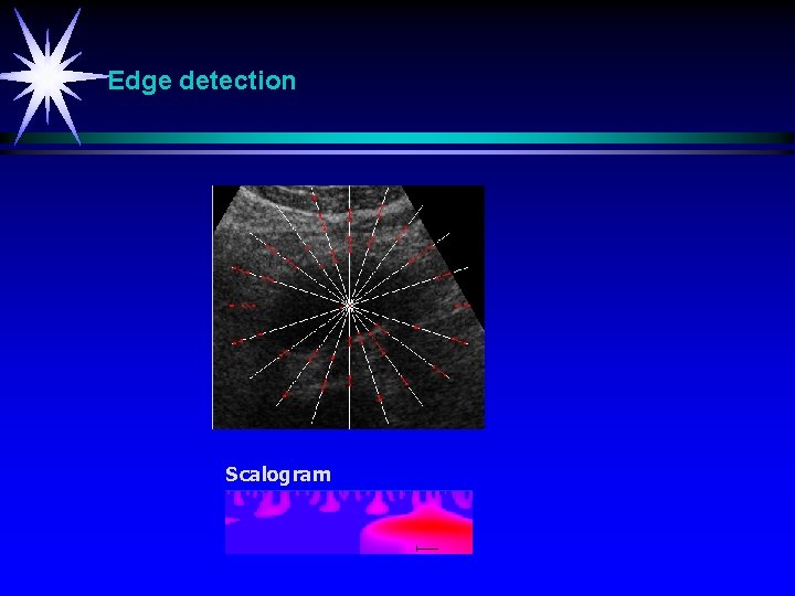 Edge detection Scalogram 