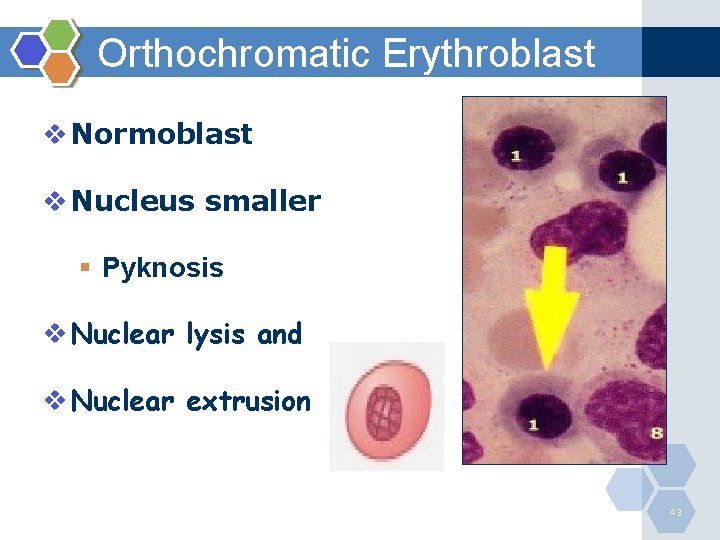 Orthochromatic Erythroblast v Normoblast v Nucleus smaller § Pyknosis v Nuclear lysis and v