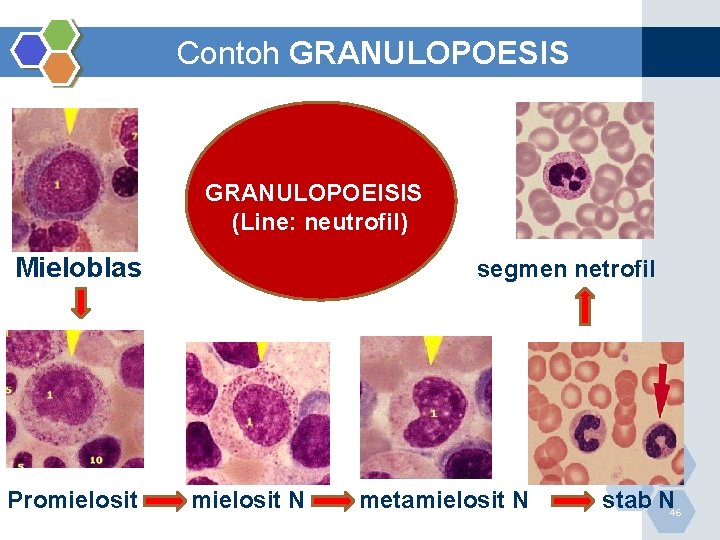 Contoh GRANULOPOESIS GRANULOPOEISIS (Line: neutrofil) Mieloblas Promielosit segmen netrofil mielosit N metamielosit N stab