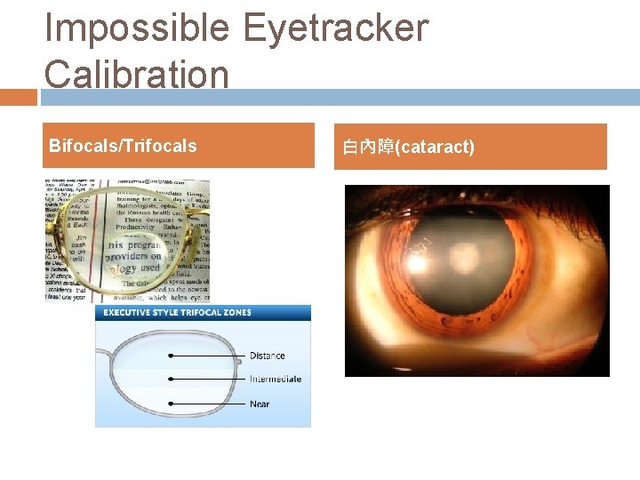 Impossible Eyetracker Calibration Bifocals/Trifocals 白內障(cataract) Impossible Eyetracker Calibration Bifocals/Trifocals 白內障(cataract)