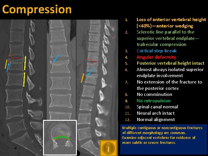Compression 1. 2. 3. 4. 5. 6. 7. 8. 9. 10. 11. 12. Loss