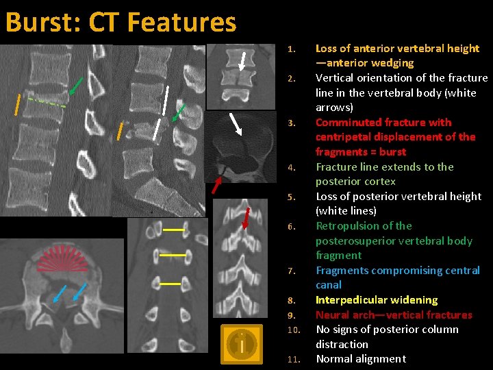 Burst: CT Features 1. 2. 3. 4. 5. 6. 7. 8. 9. 10. 11.