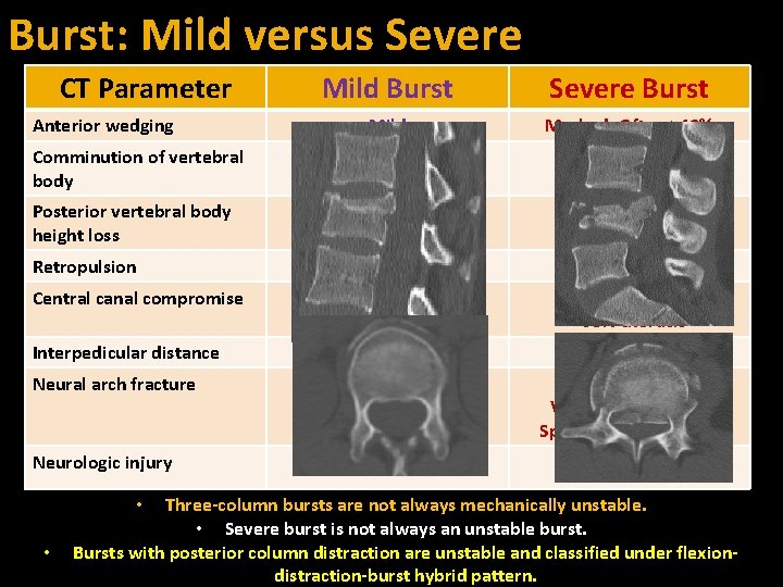 Burst: Mild versus Severe CT Parameter Mild Burst Severe Burst Anterior wedging Mild Marked-