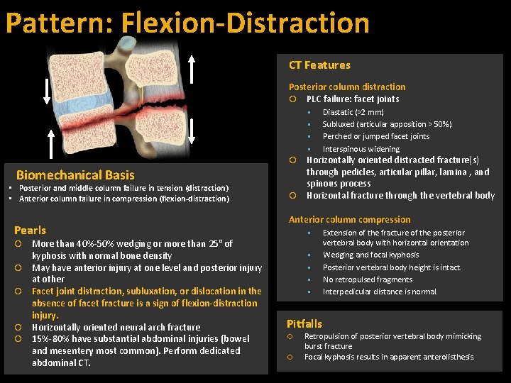 Pattern: Flexion-Distraction CT Features Posterior column distraction PLC failure: facet joints Biomechanical Basis •