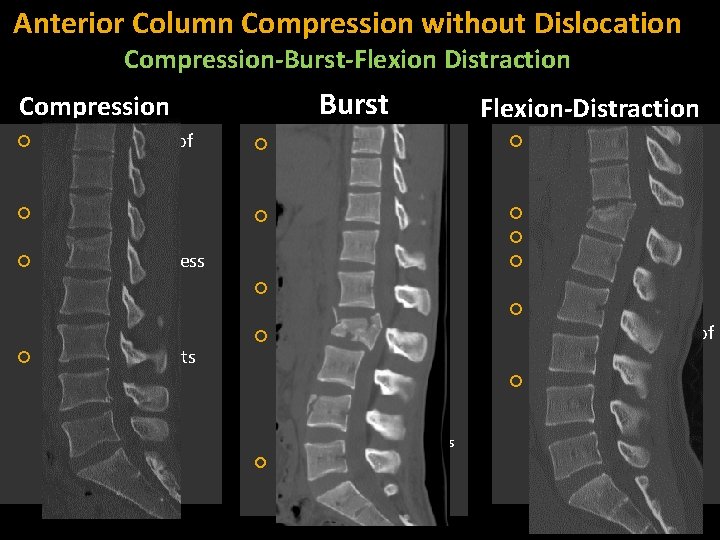 Anterior Column Compression without Dislocation Compression-Burst-Flexion Distraction Burst Compression Posterior cortex of vertebral body