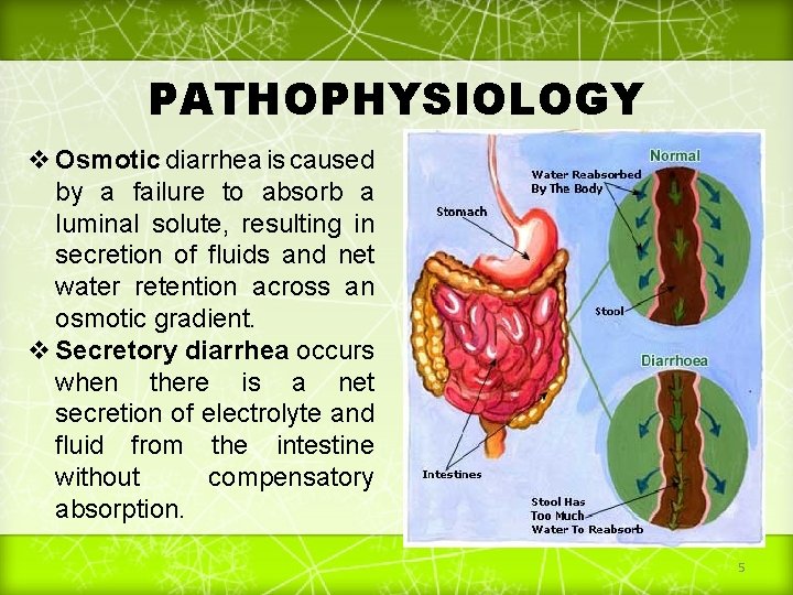 PATHOPHYSIOLOGY v Osmotic diarrhea is caused by a failure to absorb a luminal solute,