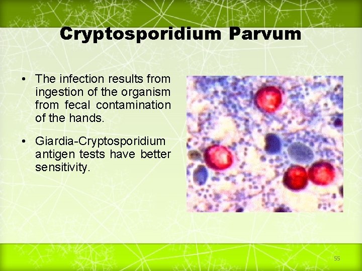 Cryptosporidium Parvum • The infection results from ingestion of the organism from fecal contamination