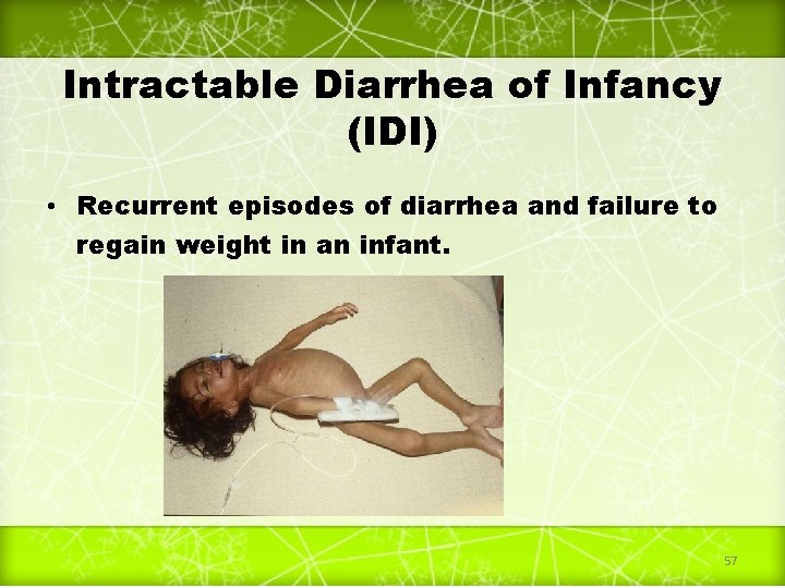 Intractable Diarrhea of Infancy (IDI) • Recurrent episodes of diarrhea and failure to regain