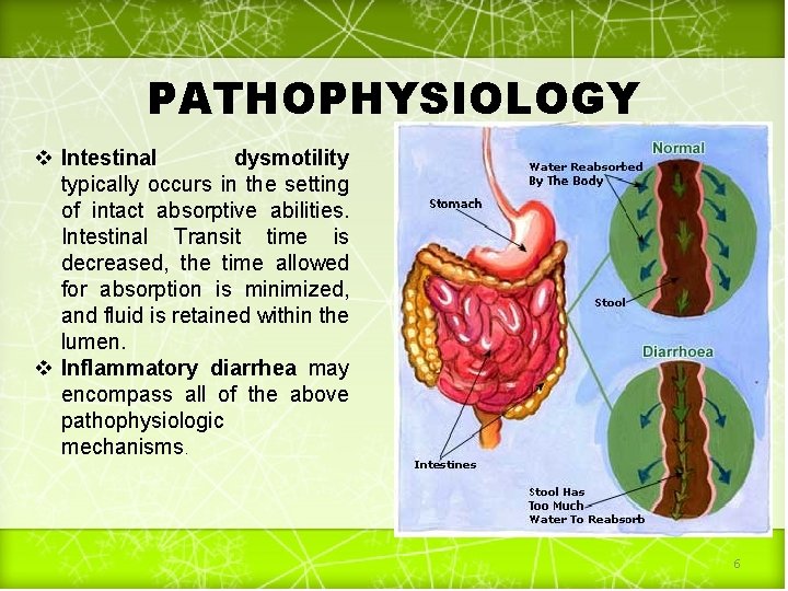 PATHOPHYSIOLOGY v Intestinal dysmotility typically occurs in the setting of intact absorptive abilities. Intestinal