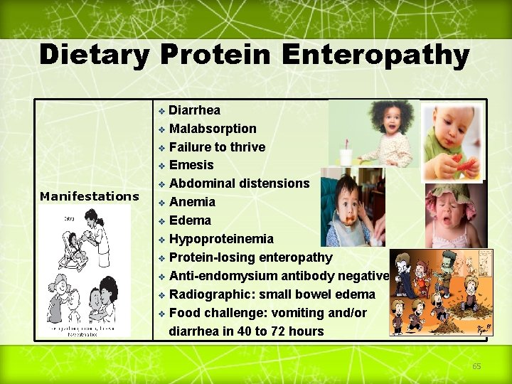 Dietary Protein Enteropathy Diarrhea v Malabsorption v Failure to thrive v Emesis v Abdominal