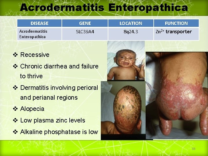 Acrodermatitis Enteropathica DISEASE Acrodermatitis Enteropathica GENE LOCATION SLC 39 A 4 8 q 24.
