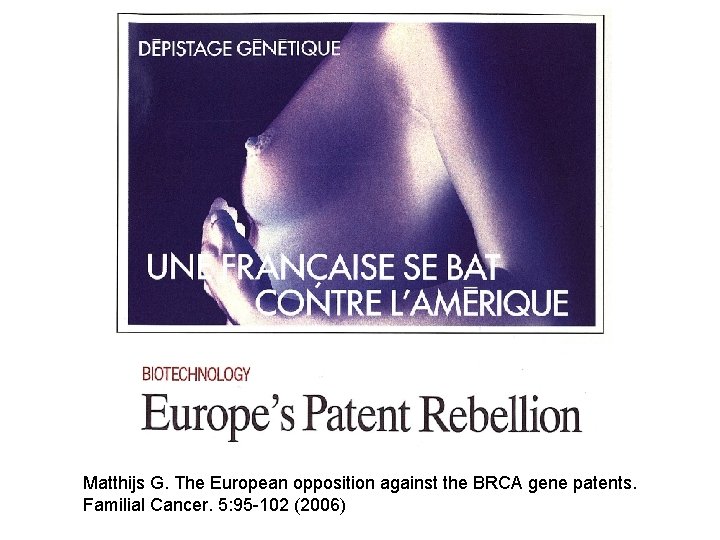 Matthijs G. The European opposition against the BRCA gene patents. Familial Cancer. 5: 95