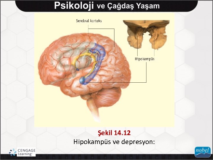 Şekil 14. 12 Hipokampüs ve depresyon: 