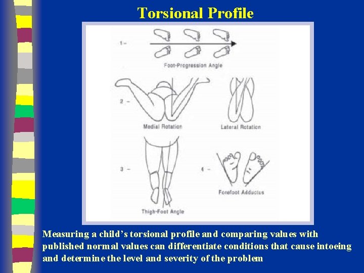 Torsional Profile Measuring a child’s torsional profile and comparing values with published normal values