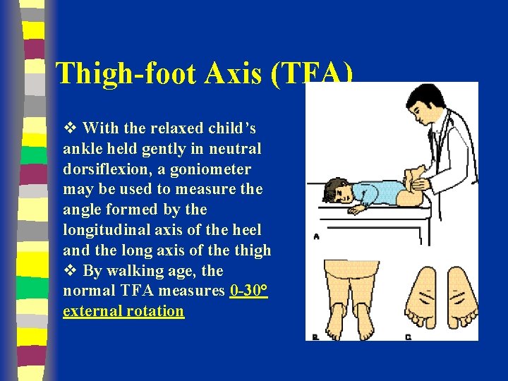 Thigh-foot Axis (TFA) v With the relaxed child’s ankle held gently in neutral dorsiflexion,