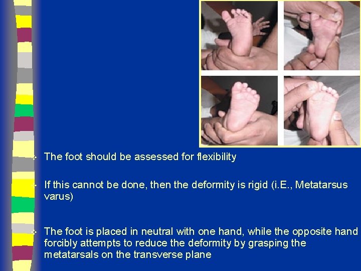 v The foot should be assessed for flexibility v If this cannot be done,