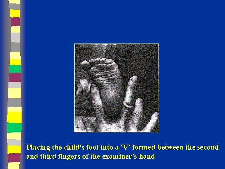 Placing the child's foot into a 'V' formed between the second and third fingers