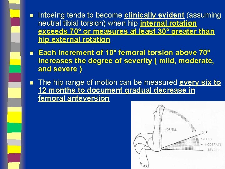 n Intoeing tends to become clinically evident (assuming neutral tibial torsion) when hip internal