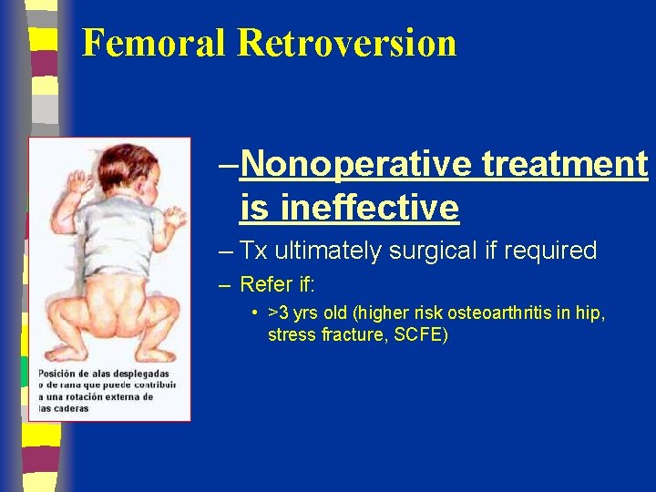 Femoral Retroversion –Nonoperative treatment is ineffective – Tx ultimately surgical if required – Refer