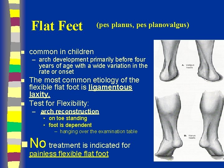 Flat Feet n (pes planus, pes planovalgus) common in children – arch development primarily