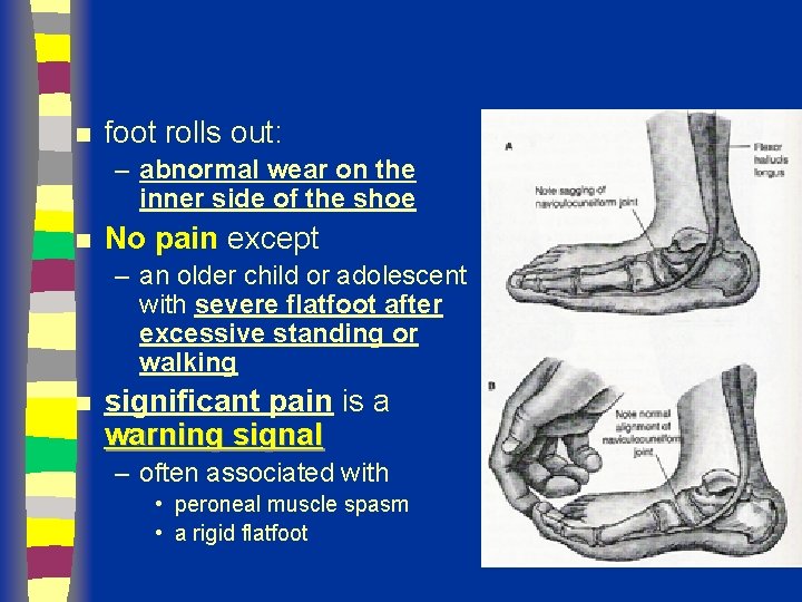 n foot rolls out: – abnormal wear on the inner side of the shoe