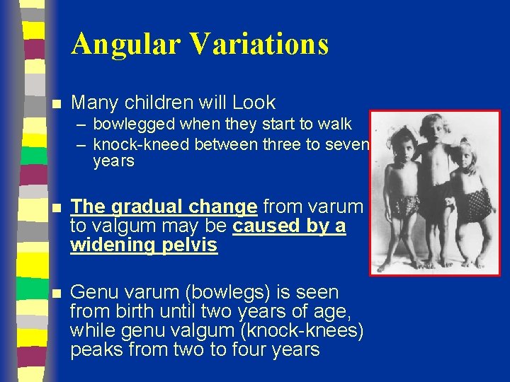Angular Variations n Many children will Look – bowlegged when they start to walk