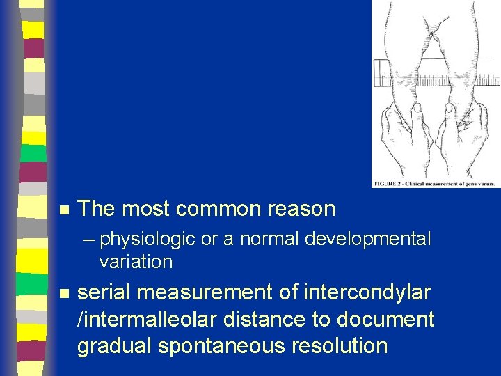 n The most common reason – physiologic or a normal developmental variation n serial