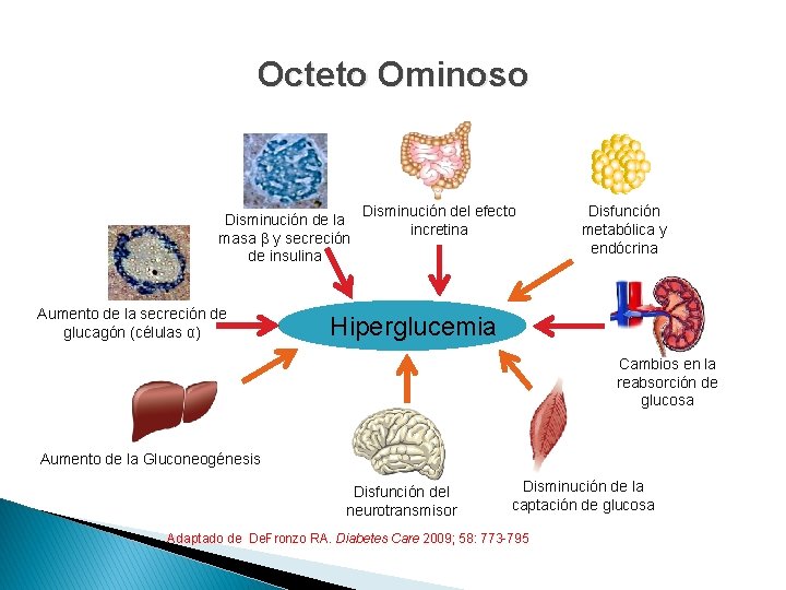 Octeto Ominoso Disminución de la masa β y secreción de insulina Aumento de la