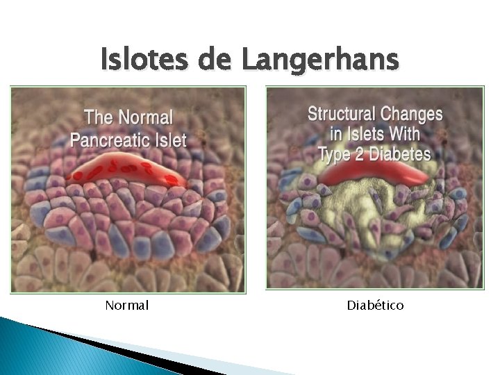 Islotes de Langerhans Normal Diabético 