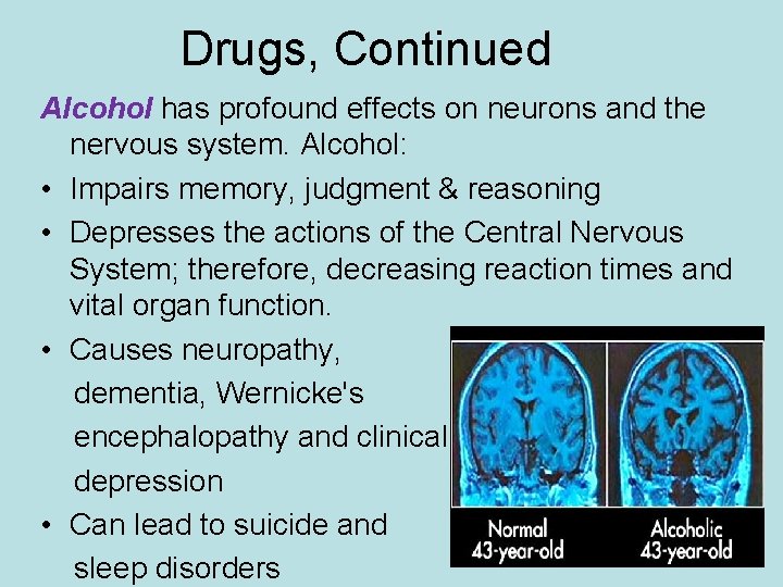Drugs, Continued Alcohol has profound effects on neurons and the nervous system. Alcohol: •