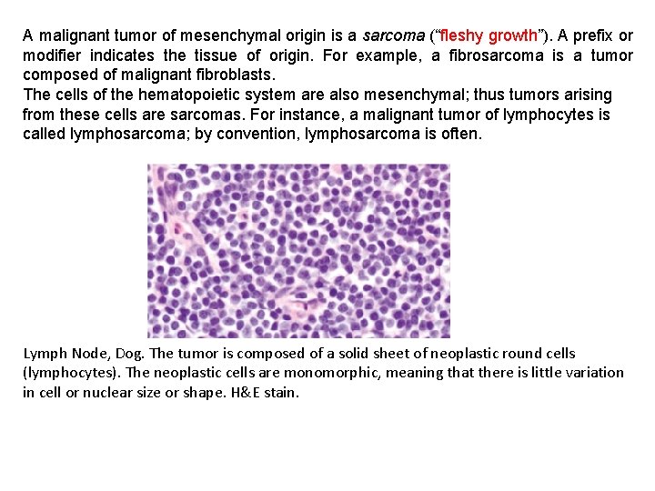 A malignant tumor of mesenchymal origin is a sarcoma (“fleshy growth”). A prefix or