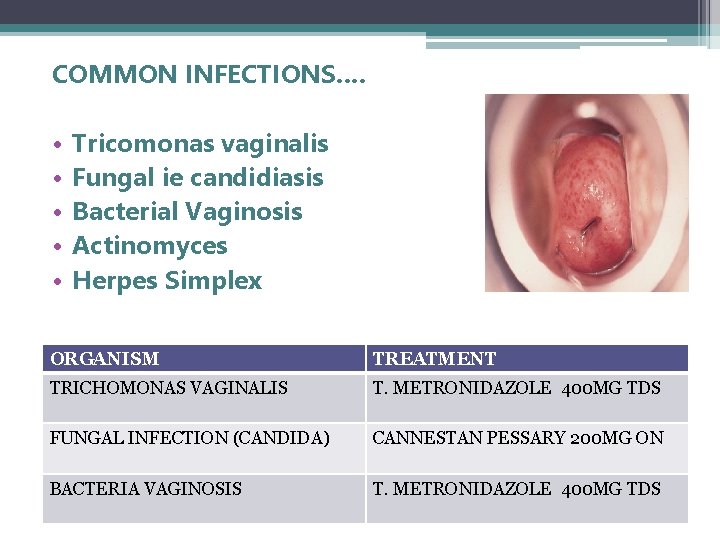 COMMON INFECTIONS…. • • • Tricomonas vaginalis Fungal ie candidiasis Bacterial Vaginosis Actinomyces Herpes