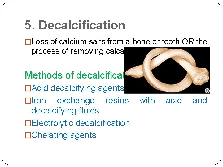 5. Decalcification �Loss of calcium salts from a bone or tooth OR the process