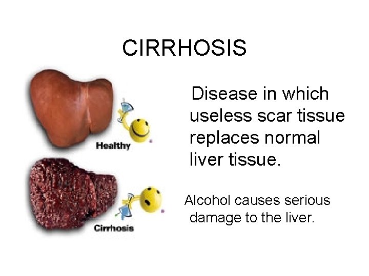 CIRRHOSIS Disease in which useless scar tissue replaces normal liver tissue. Alcohol causes serious