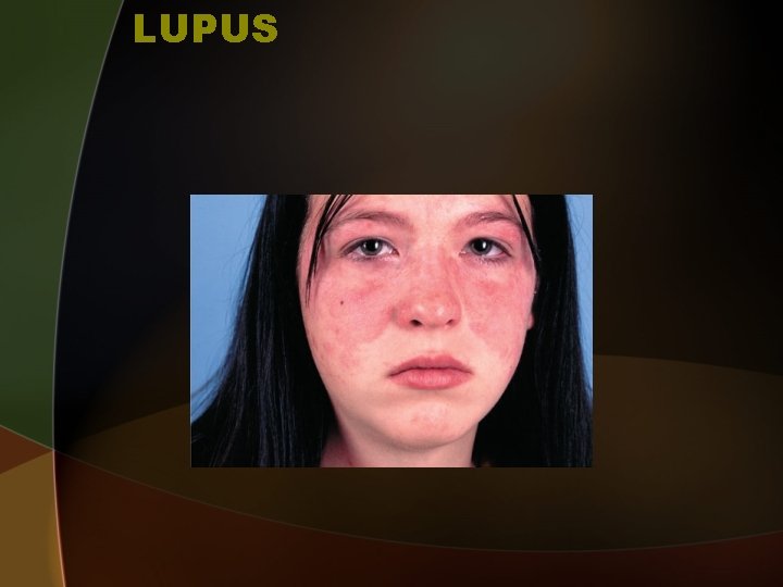 LUPUS 