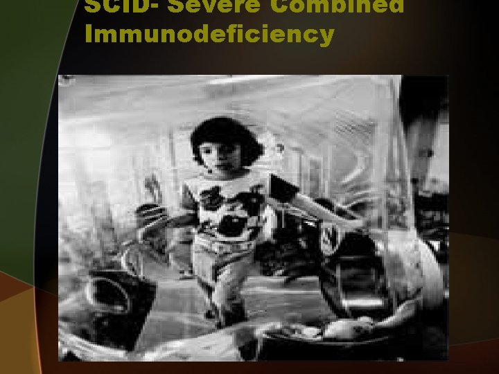 SCID- Severe Combined Immunodeficiency 