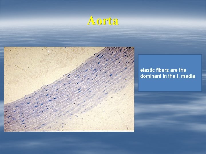 Aorta elastic fibers are the dominant in the t. media 