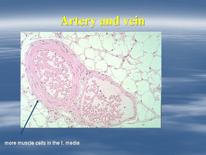 Artery and vein more muscle cells in the t. media 