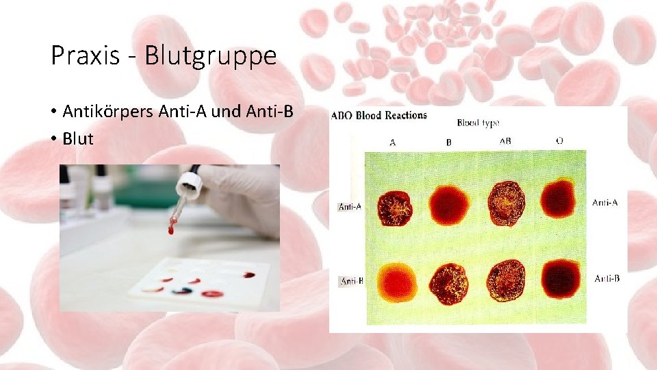 Praxis - Blutgruppe • Antikörpers Anti-A und Anti-B • Blut 