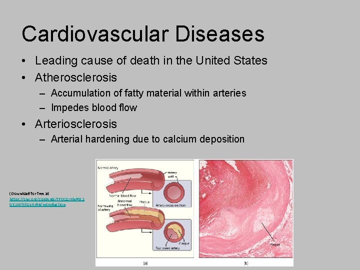 Cardiovascular Diseases • Leading cause of death in the United States • Atherosclerosis –