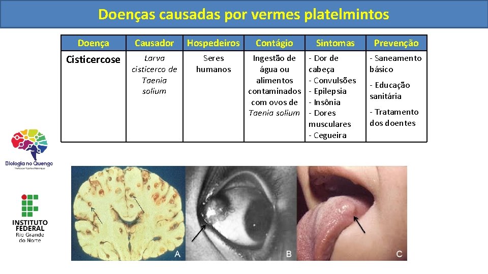 Helmintoses Biologia Helmintoses Doenas causadas por vermes platelmintos
