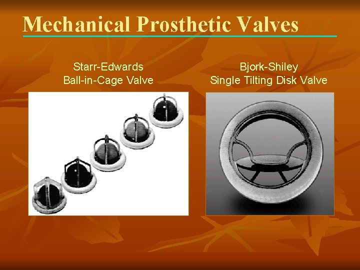 Mechanical Prosthetic Valves Starr-Edwards Ball-in-Cage Valve Bjork-Shiley Single Tilting Disk Valve 