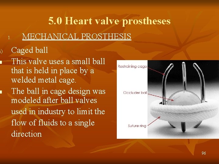 a) n n 5. 0 Heart valve prostheses 1. MECHANICAL PROSTHESIS Caged ball This