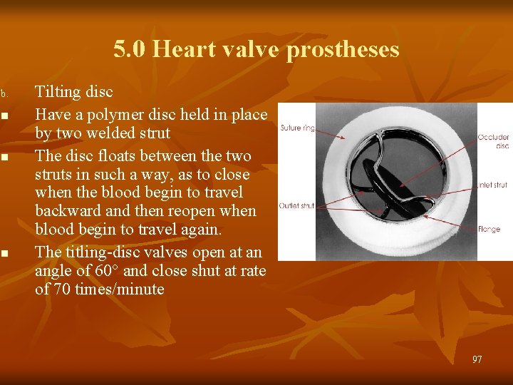 5. 0 Heart valve prostheses b. n n n Tilting disc Have a polymer