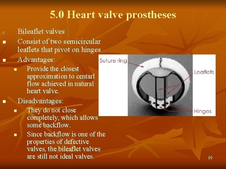 5. 0 Heart valve prostheses Bileaflet valves Consist of two semicircular leaflets that pivot