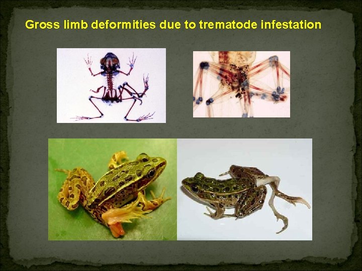 Gross limb deformities due to trematode infestation 
