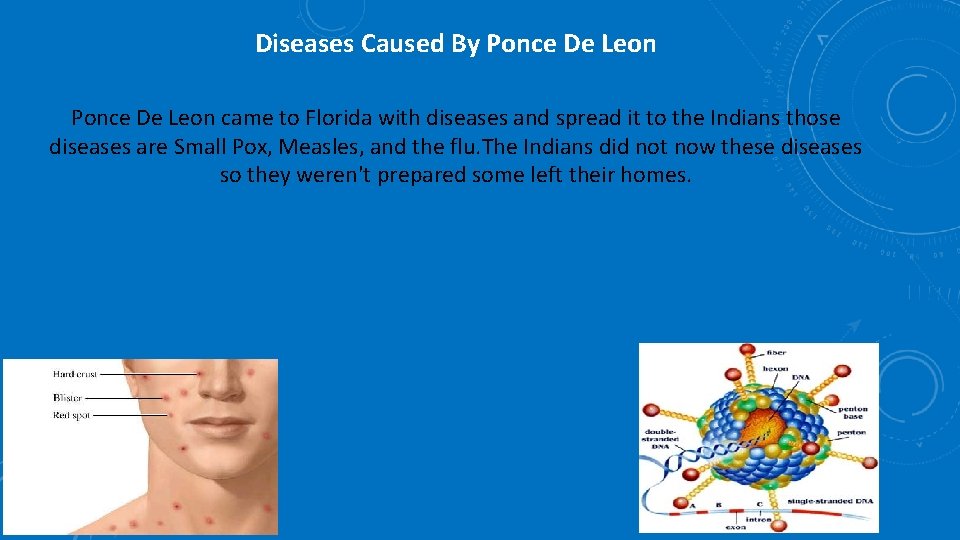 Diseases Caused By Ponce De Leon came to Florida with diseases and spread it